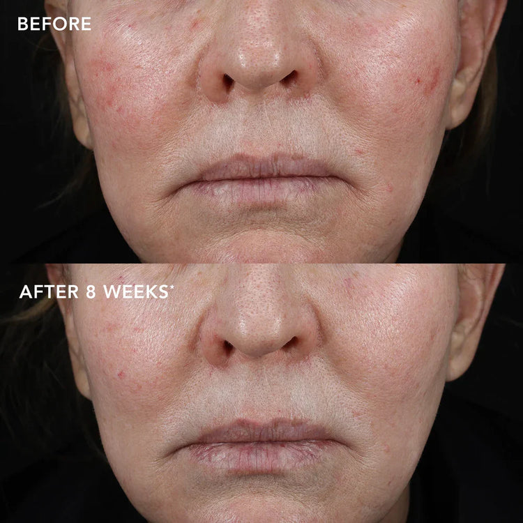 MD Biotech Longevity Creme