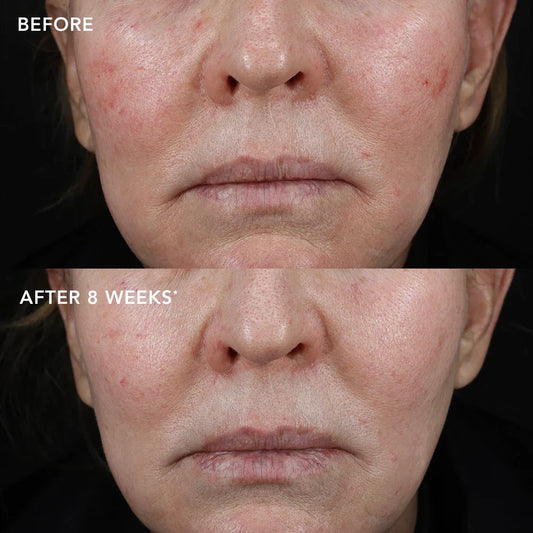 MD Biotech Longevity Creme