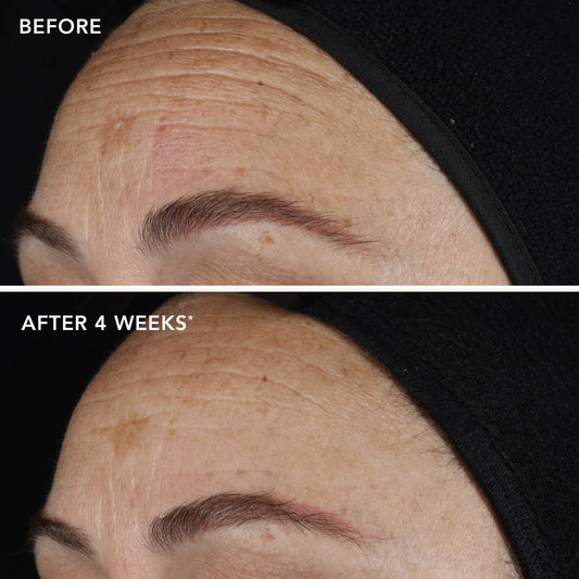 Ageless+ Pure Liquid Retinol 0.1%