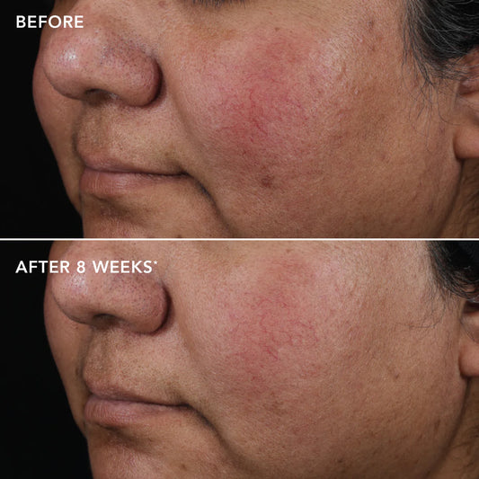 Ageless+ Pure Liquid Retinol 0.75%