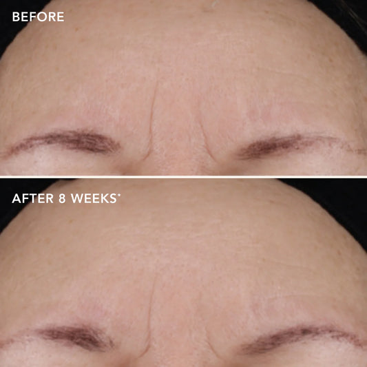 Ageless+ Retinol Treatment Creme 1.2% Complex