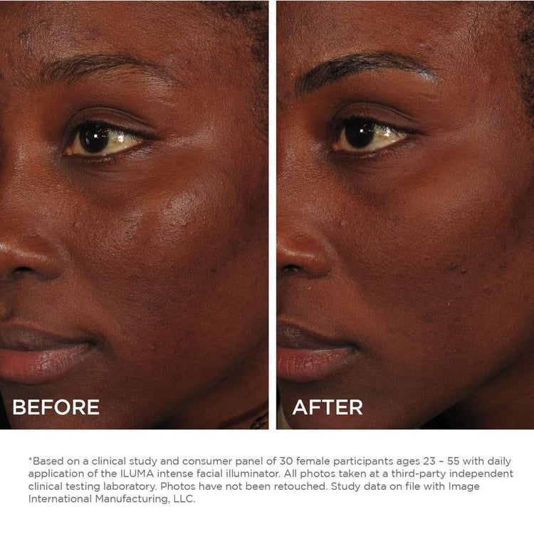 Iluma Facial Illuminator NEW